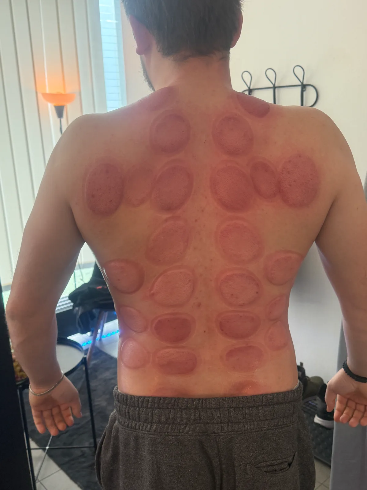 Diagnostika, baňkování, závěrečná masáž – ukázka práce, Golden Hands Massage